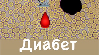 Диагноз диабет