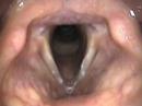Anatomical Tutorial During Trans Nasal