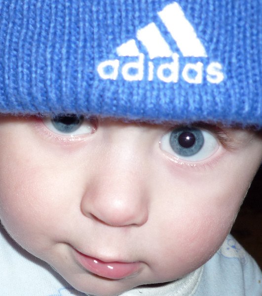 Толик Ясинский | Шаровка