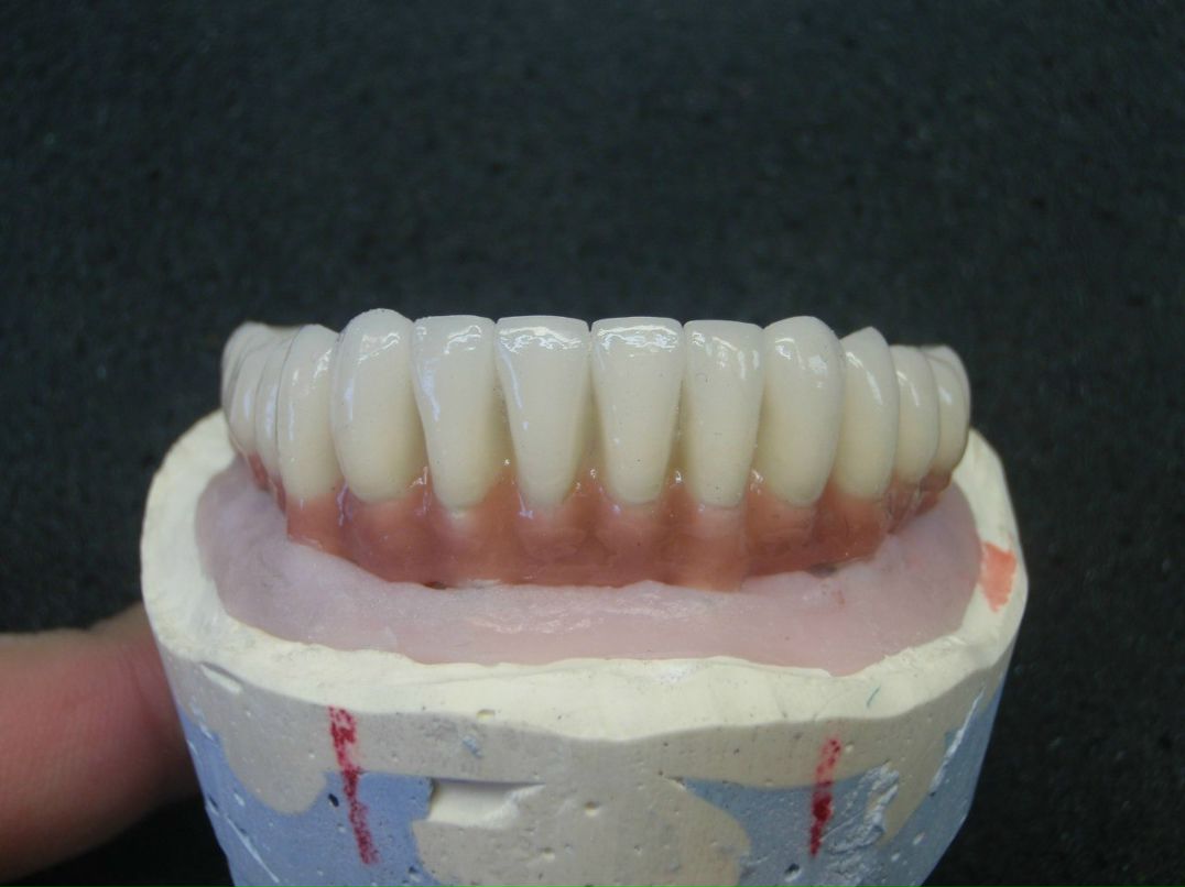 Эрнест Абрамян | Москва