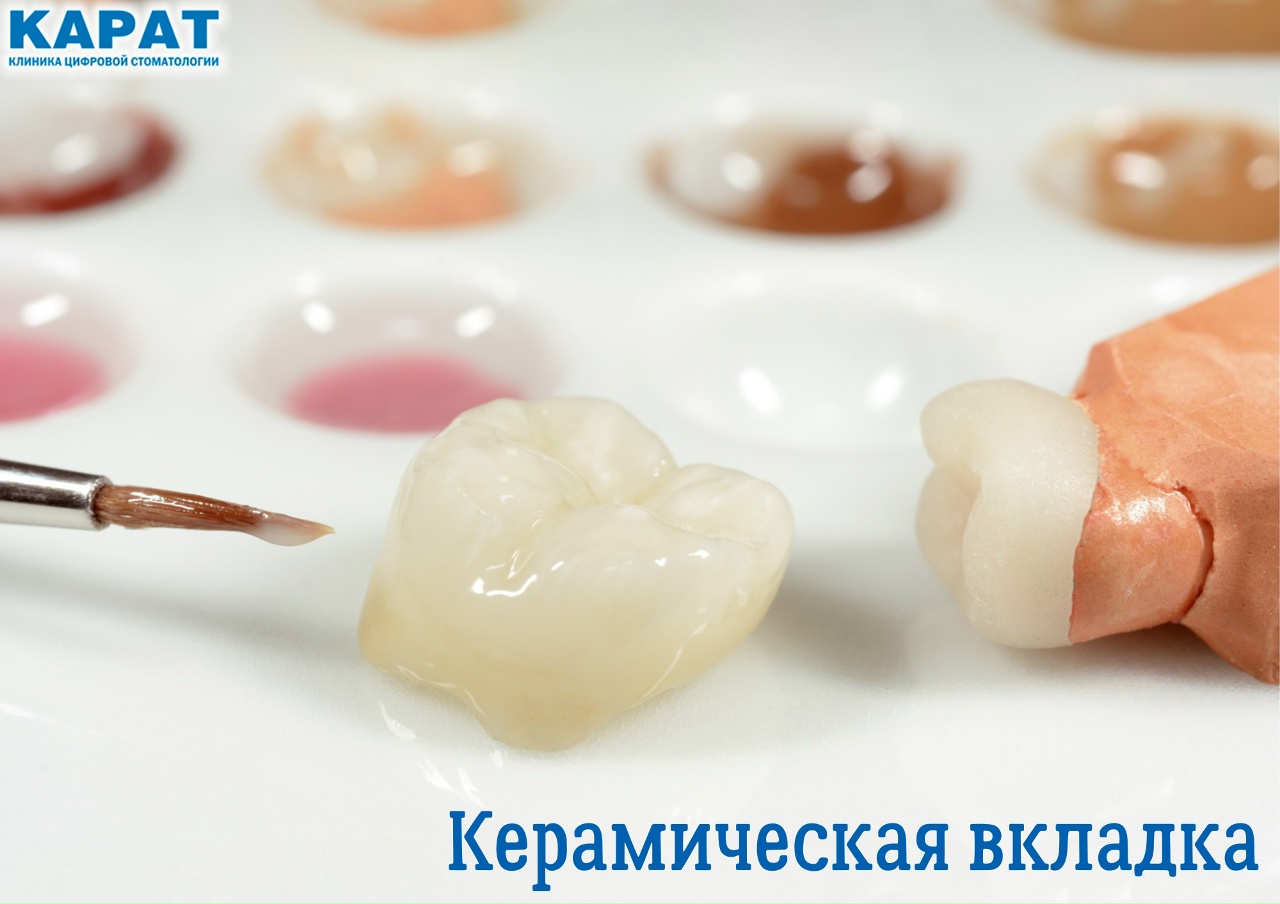 Вкладки картинки. Керамические вкладки Emax. Керамическая вкладка ИМАКС. Микропротезирование зубов вкладками. Вкладки картинки. Керамические вкладки Emax. Керамическая вкладка ИМАКС. Микропротезирование зубов вкладками.