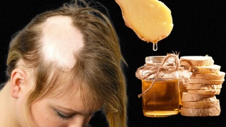 Von Kahlheit und Haarausfall!💯 Haare wachsen wie verrückt. Das ist das beste Mittel!🔥