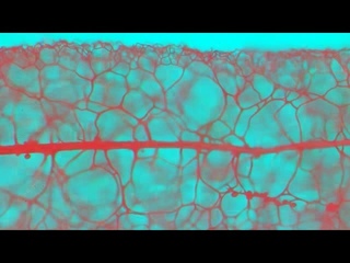 Observing the capillitium of Stemonitis